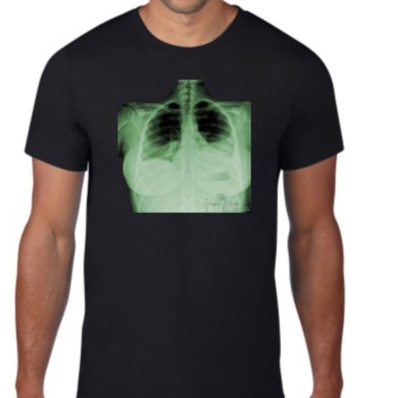 PRE ORDER - Chest XRay T-Shirt